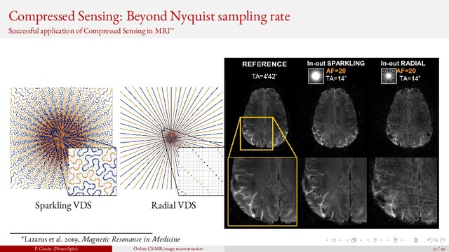 Compressed Sensing: Beyond Nyquist sampling rate
Successful application of Compressed Sensing in MRI10
Sparkling VDS Radial VDS
9Lazarus et al. 2019, Magnetic Resonance in Medicine
P. Ciuciu (NeuroSpin) Online CS-MR image reconstruction 13 / 50

