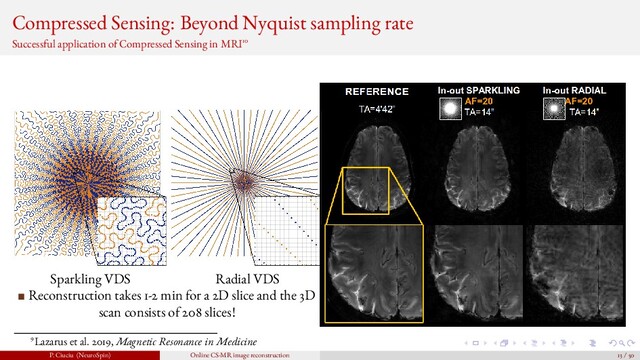 Compressed Sensing: Beyond Nyquist sampling rate
Successful application of Compressed Sensing in MRI10
Sparkling VDS Radial VDS
Reconstruction takes 1-2 min for a 2D slice and the 3D
scan consists of 208 slices!
9Lazarus et al. 2019, Magnetic Resonance in Medicine
P. Ciuciu (NeuroSpin) Online CS-MR image reconstruction 13 / 50
