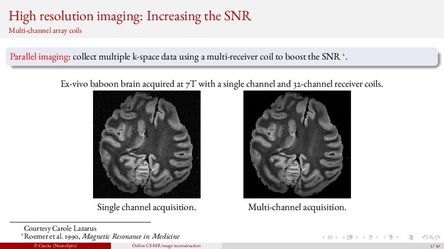High resolution imaging: Increasing the SNR
Multi-channel array coils
Parallel imaging: collect multiple k-space data using a multi-receiver coil to boost the SNR 2.
Ex-vivo baboon brain acquired at 7T with a single channel and 32-channel receiver coils.
Single channel acquisition. Multi-channel acquisition.
Courtesy Carole Lazarus
2Roemer et al. 1990, Magnetic Resonance in Medicine
P. Ciuciu (NeuroSpin) Online CS-MR image reconstruction 5 / 50
