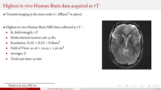 Highest in vivo Human Brain data acquired at 7T
Towards imaging at the meso-scale ( 100µm2 in plane)
Highest in-vivo Human Brain MRI data collected at 7T 3:
• B0 eld strength: 7T
• Multi-channel receiver coil: 32 Rx
• Resolution: 0.12 × 0.12 × 0.6mm3
• Field of View: 20.28 × 20.93 × 1.26 cm3
• Averages: 2
• Total scan time: 50 min
3Stucht et al. 2015, PloS one
P. Ciuciu (NeuroSpin) Online CS-MR image reconstruction 6 / 50

