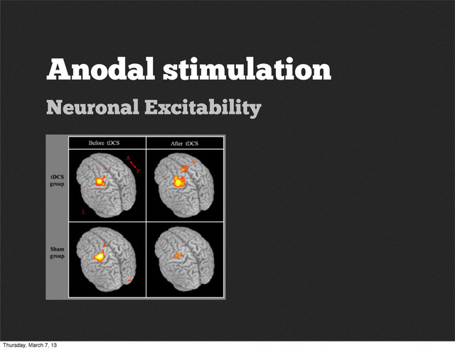 Anodal stimulation
Neuronal Excitability
Thursday, March 7, 13
