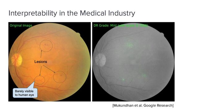 Interpretability in the Medical Industry
[Mukundhan et al. Google Research]
